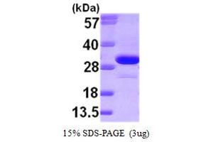 SDS-PAGE (SDS) image for Ketohexokinase (KHK) (AA 1-298) protein (ABIN666920) (Ketohexokinase Protein (KHK) (AA 1-298))