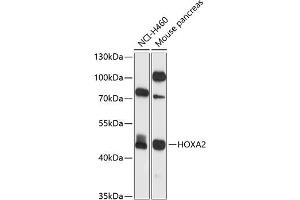 Western blot analysis of extracts of various cell lines, using HOX antibody (ABIN6128061, ABIN6141938, ABIN6141939 and ABIN6225060) at 1:1000 dilution.