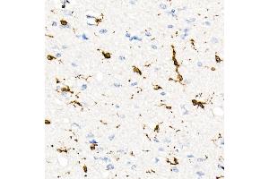 Immunohistochemistry of paraffin-embedded Human brain using CD74 antibody (ABIN7267759) at dilution of 1:100 (40x lens). (CD74 antibody)