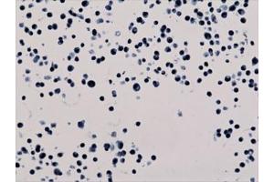 ICC staining of human HepG2 cells with recombinant H3K56ac antibody. (Recombinant Histone 3 antibody  (H3K56ac))