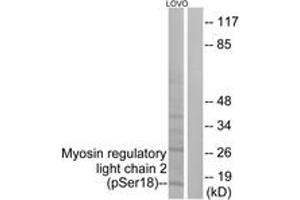 Western blot analysis of extracts from LOVO cells treated with H2O2 100uM 30', using Myosin regulatory light chain 2 (Phospho-Ser18) Antibody.
