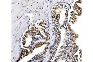 IHC analysis of NOLA1/GAR1 using anti-NOLA1/GAR1 antibody (ABIN7602076). (GAR1 antibody  (AA 58-165))