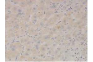 Detection of STAT3 in Human Liver Tissue using Polyclonal Antibody to Signal Transducer And Activator Of Transcription 3 (STAT3)