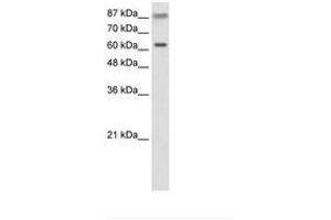 Image no. 1 for anti-Tripartite Motif Containing 35 (TRIM35) (AA 401-450) antibody (ABIN203181) (TRIM35 antibody  (AA 401-450))