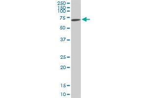 AKT3 monoclonal antibody (M06), clone 2H4. (AKT3 antibody  (AA 100-189))