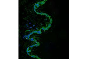 Immunofluorescence (IF) image for anti-Src-Related Kinase Lacking C-Terminal Regulatory Tyrosine and N-Terminal Myristylation Sites (SRMS) (AA 113-147) antibody (ABIN6244149)