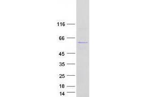 Western Blotting (WB) image for UBX Domain Protein 6 (UBXN6) protein (Myc-DYKDDDDK Tag) (ABIN2734942)