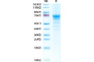 Mouse CRTAM on Tris-Bis PAGE under reduced condition. (CRTAM Protein (AA 17-289) (His tag))
