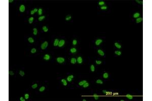 Immunofluorescence of monoclonal antibody to DDX41 on HeLa cell. (DDX41 antibody  (AA 523-622))