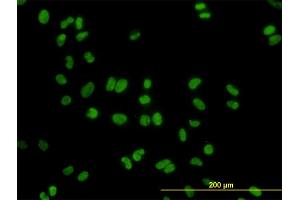 Immunofluorescence of monoclonal antibody to DDX41 on HeLa cell.