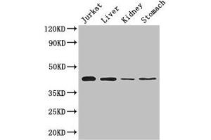 Western Blot Positive WB detected in: Jurkat whole cell lysate, Mouse liver tissue, Mouse kidney tissue, Mouse stomach tissue All lanes: Hoxa2 antibody at 2 μg/mL Secondary Goat polyclonal to rabbit IgG at 1/50000 dilution Predicted band size: 42 kDa Observed band size: 42 kDa (HOXA2 antibody  (AA 26-124))
