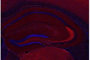 Immunohistochemistry (IHC) image for anti-Syntaxin Binding Protein 1 (STXBP1) antibody (ABIN4889918)