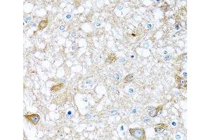 Immunohistochemistry (Paraffin-embedded Sections) (IHC (p)) image for anti-Bone Morphogenetic Protein 5 (BMP5) antibody (ABIN7264429)
