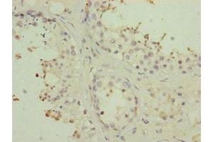Immunohistochemistry of paraffin-embedded human testis tissue using ABIN7159960 at dilution of 1:100 (PMPCB antibody  (AA 110-380))
