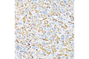 Immunohistochemistry of paraffin-embedded rat ovary using Sec23AA Rabbit mAb (ABIN7270168) at dilution of 1:100 (40x lens). (SEC23A antibody)