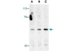 Western blot analysis of ATG7 in Caco-2 cell lysate with ATG7 polyclonal antibody  at (A) 0. (ATG7 antibody  (C-Term))