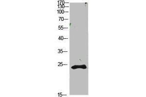 Western Blot analysis of 1,mouse-kidney cells using primary antibody diluted at 1:1000(4 °C overnight).