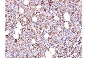 Immunohistochemistry (IHC) image for anti-Ribosomal Protein S3 (RPS3) antibody (ABIN2855736)