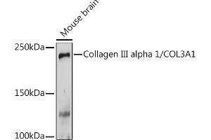 Western blot analysis of extracts of Mouse brain, using Collagen III alpha 1/COL3 Rabbit pAb (ABIN1679317, ABIN3018108, ABIN3018109 and ABIN6220366) at 1:1000 dilution.