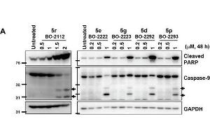 Western Blotting (WB) image for anti-Glyceraldehyde-3-Phosphate Dehydrogenase (GAPDH) antibody (ABIN2857072)