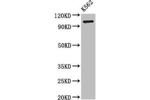 Western Blot Positive WB detected in: K562 whole cell lysate All lanes: ERAP1 antibody at 3. (ERAP1 antibody  (AA 642-941))