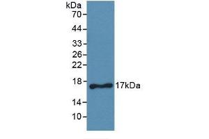 Detection of Recombinant CD40L, Human using Monoclonal Antibody to Cluster Of Differentiation 40 Ligand (CD40L) (CD40 Ligand antibody  (AA 180-261))