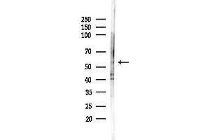 Western blot analysis of lysates from Rat liver, using FGB Antibody at 1/1000 dilution.