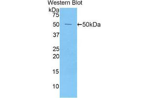 Western Blotting (WB) image for anti-Peroxiredoxin 1 (PRDX1) (AA 1-199) antibody (ABIN1860301) (Peroxiredoxin 1 antibody  (AA 1-199))