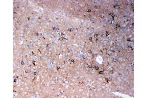 Anti-TNR antibody,  IHC(P) IHC(P): Rat Brain Tissue (Tenascin R antibody  (N-Term))