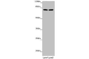 Western blot All lanes: FBXL5 antibody at 1. (FBXL5 antibody  (AA 1-310))