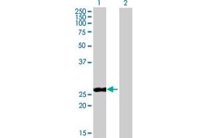 Western Blot analysis of PPP2R3B expression in transfected 293T cell line by PPP2R3B MaxPab polyclonal antibody. (PPP2R3B antibody  (AA 1-176))