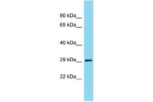 Host: Rabbit Target Name: ARHGAP11B Sample Type: Fetal Heart lysates Antibody Dilution: 1. (ARHGAP11B antibody  (C-Term))