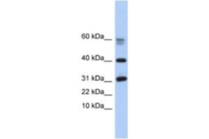 Western Blotting (WB) image for anti-Hypothetical Protein LOC339047 (LOC339047) antibody (ABIN2463950)