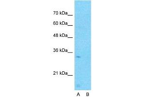 Host:  Rabbit  Target Name:  CCDC90A  Sample Type:  Human Fetal Lung  Lane A:  Primary Antibody  Lane B:  Primary Antibody + Blocking Peptide  Primary Antibody Concentration:  1ug/ml  Peptide Concentration:  5ug/ml  Lysate Quantity:  25ug/lane/lane  Gel Concentration:  0. (CCDC90A antibody  (Middle Region))