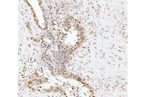 IHC analysis of RRP4/EXOSC2 using anti-RRP4/EXOSC2 antibody (ABIN7602188). (EXOSC2 antibody  (AA 62-293))