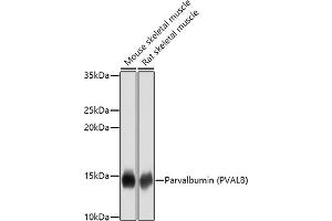 Western blot analysis of extracts of various cell lines, using Parvalbumin (PVALB) antibody (ABIN3016700, ABIN3016701, ABIN3016702 and ABIN6219820) at 1:1000 dilution. (PVALB antibody)