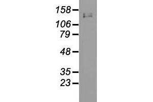 Western blot analysis of 35 µg of cell extracts from human Liver carcinoma (HepG2) cells using anti-L1CAM antibody. (L1CAM antibody)