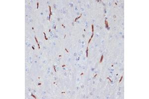 Immunohistochemistry of paraffin-embedded mouse brain using  antibody (ABIN6129926, ABIN6136997, ABIN6136998 and ABIN6218500) at dilution of 1:100 (40x lens). (APOA1 antibody  (AA 25-267))