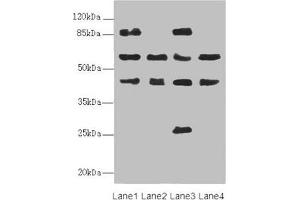 Western blot All lanes: FLVCR2 antibody at 0.