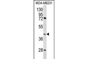 Western blot analysis of HOMER3 Antibody (Center) (ABIN652274 and ABIN2841157) in MDA-M cell line lysates (35 μg/lane). (HOMER3 antibody  (AA 281-308))