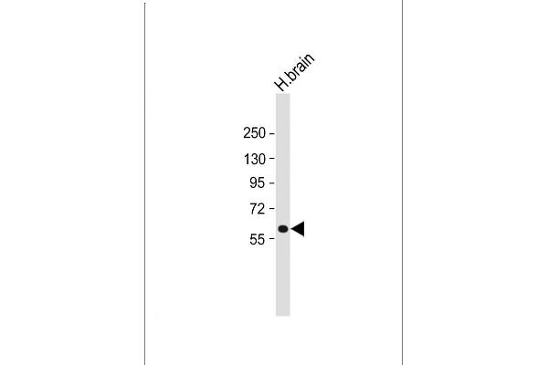 Hexosaminidase A antibody  (N-Term)