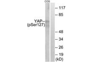 Western blot analysis of extracts from COS7 cells treated with HU 2nM 24h, using YAP (Phospho-Ser127) Antibody. (YAP1 antibody  (pSer127))