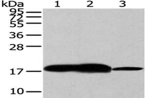 Gel: 12 % SDS-PAGE,Lysate: 40 μg,Lane 1-3: Human fetal brain tissue, Mouse brain tissue, Hela cells,Primary antibody: ABIN7193008(VAMP2 Antibody) at dilution 1/200 dilution,Secondary antibody: Goat anti rabbit IgG at 1/8000 dilution,Exposure time: 30 seconds (VAMP2 antibody)