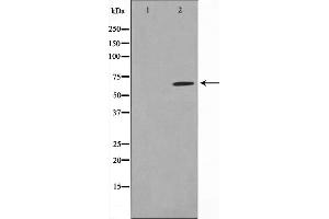 Western blot analysis on MDA-MB-435 cell lysate using PIAS1 Antibody,The lane on the left is treated with the antigen-specific peptide.
