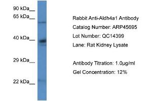 Western Blotting (WB) image for anti-Aldehyde Dehydrogenase 4 Family, Member A1 (ALDH4A1) (N-Term) antibody (ABIN2782322) (ALDH4A1 antibody  (N-Term))