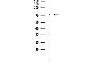 anti-Chloride Channel Ka (CLCNKA) (C-Term) antibody