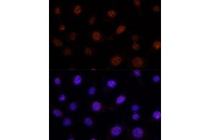 Immunofluorescence analysis of L-929 cells using GLI2 antibody (ABIN7267384) at dilution of 1:100. (GLI2 antibody)