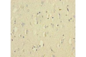 Immunohistochemistry of paraffin-embedded human brain tissue using ABIN7175654 at dilution of 1:100 (VWF antibody  (AA 1-273))