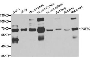 Western blot analysis of extracts of various cell lines, using PUF60 antibody (ABIN5974052) at 1/1000 dilution. (PUF60 antibody)