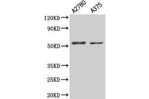 Western Blot Positive WB detected in: A2780 whole cell lysate, A375 whole cell lysate All lanes: PAX3 antibody at 5. (Paired Box 3 antibody  (AA 90-184))